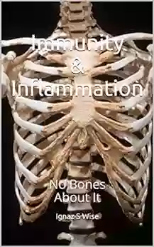 Immunity Inflammation: No Bones About It (Immunity And Inflammation)