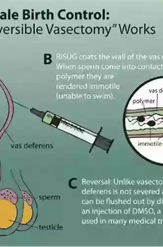 Gossypol: A Potential Contraceptive For Men (Reproductive Biology)