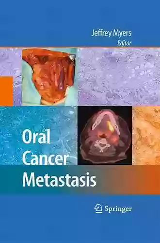 Oral Cancer Metastasis Jeffrey Myers