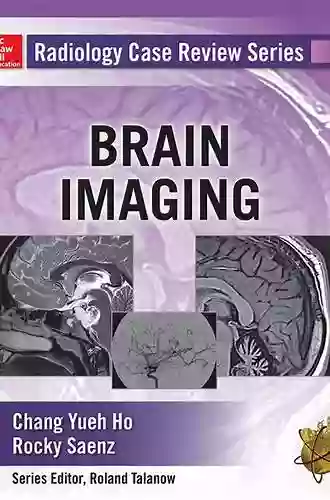 Radiology Case Review Series: Brain Imaging