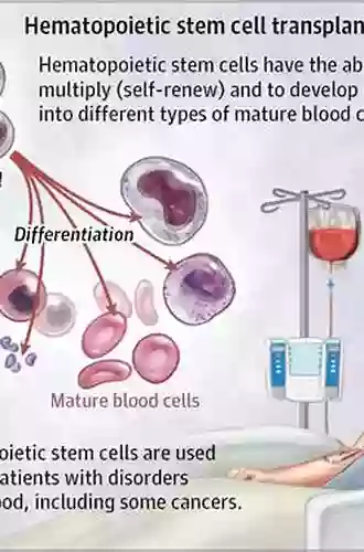 The EBMT Handbook: Hematopoietic Stem Cell Transplantation And Cellular Therapies