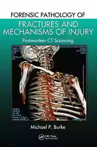 Forensic Pathology Of Fractures And Mechanisms Of Injury: Postmortem CT Scanning