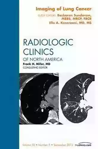 Lung Cancer An Issue of Radiologic Clinics of North America (The Clinics: Radiology 56)