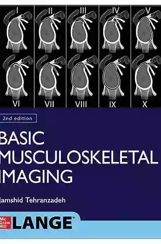 Basic Musculoskeletal Imaging Second Edition