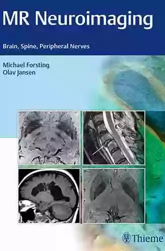 MR Neuroimaging: Brain Spine Peripheral Nerves