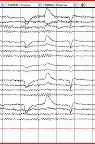 How To Read An EEG