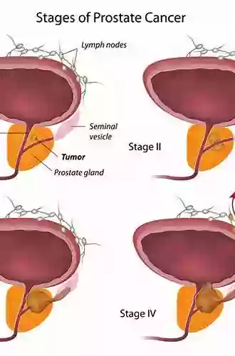 Prostate Awareness: What Is The Prostate And What Is Prostate Cancer (Men S Health)