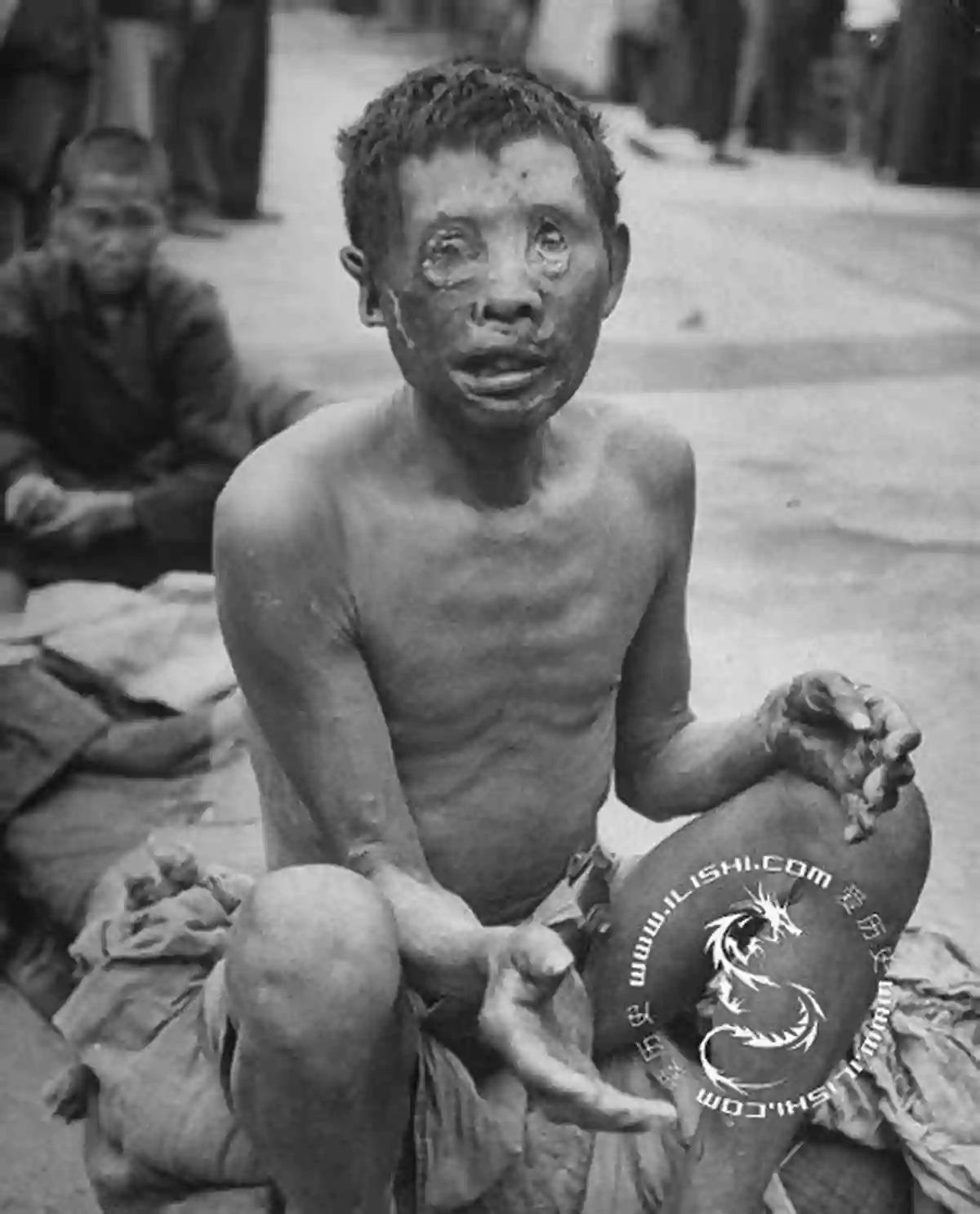 Mao Great Famine: A Photo Of A Starving Child During The Great Famine In China Mao S Great Famine: The History Of China S Most Devastating Catastrophe 1958 1962